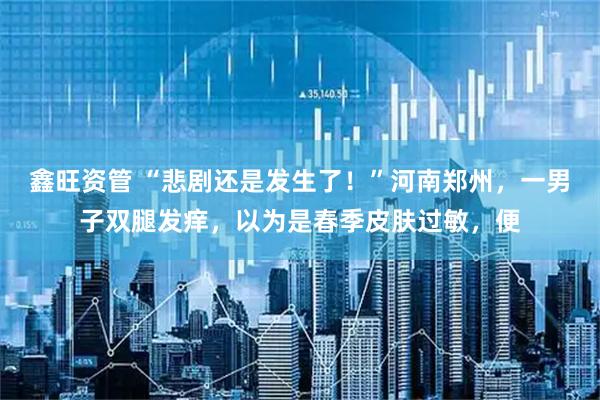 鑫旺资管 “悲剧还是发生了！”河南郑州，一男子双腿发痒，以为是春季皮肤过敏，便